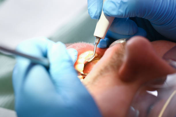 Best Pediatric Emergency Dentist in Dent, OH