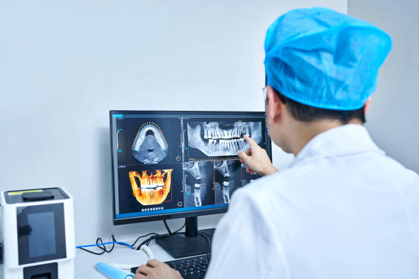 Best Emergency Wisdom Teeth Removal in Dent, OH